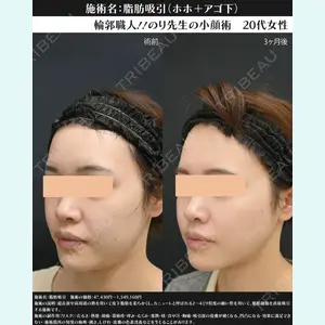 湘南美容クリニック 川崎院 伊藤 賀敏医師の症例