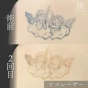 ziz CLINIC 村岡 史子医師の症例