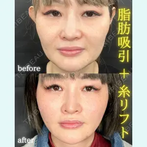 THE FIRST CLINIC 町田院 木暮 啓一郎医師の症例