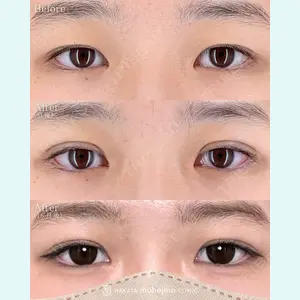 症例
