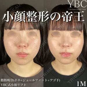 症例