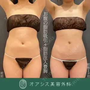 オアシス美容外科 遠藤 剛史医師の症例