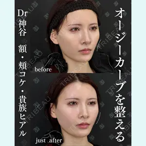 EMMO FACE CLINIC 大阪梅田院 神谷 一成医師の症例