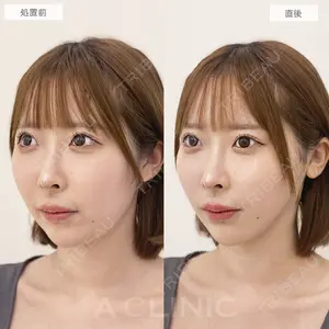 A CLINIC（エークリニック） 福岡院 高平 青洋医師の症例