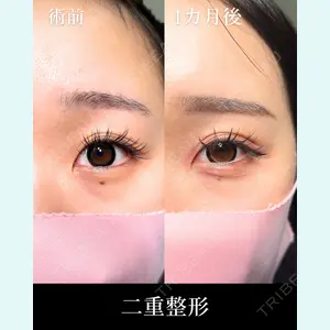 症例