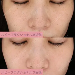 AZ BEAUTY CLINICの症例