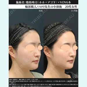 湘南美容クリニック 川崎院 伊藤 賀敏医師の症例