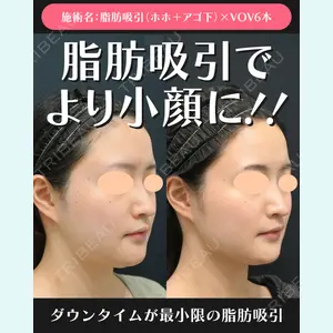 湘南美容クリニック 川崎院 伊藤 賀敏医師の症例