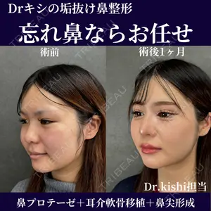 症例