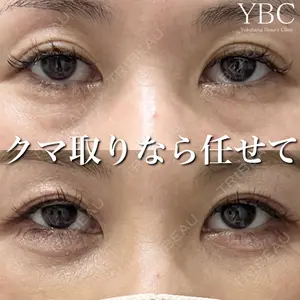 症例