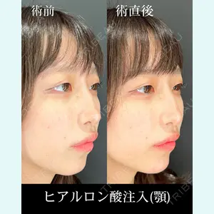 症例