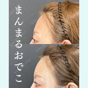 Tokyo Tensei Clinic 銀座院 宮田康生医師の症例