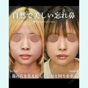 シンデレラ＆ダヴィンチクリニック 宮田 洋佑医師の症例