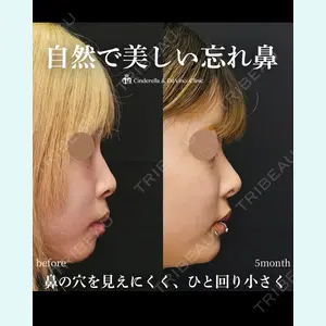 シンデレラ＆ダヴィンチクリニック 宮田 洋佑医師の症例