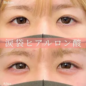 症例