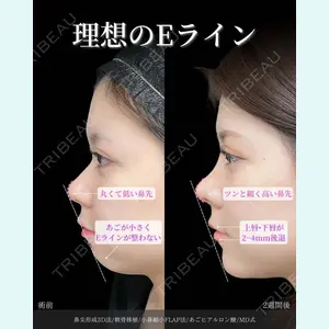 東京シンデレラ美容外科 新宿院 吉原 伯医師の症例