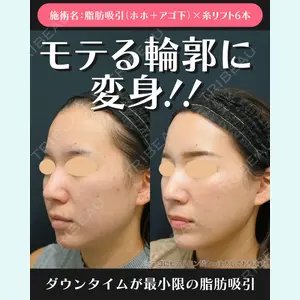 湘南美容クリニック 川崎院 伊藤 賀敏医師の症例