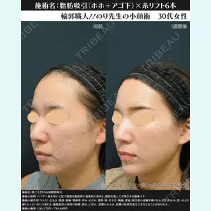 湘南美容クリニック 川崎院 伊藤 賀敏医師の症例