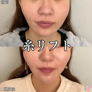 症例