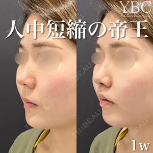 症例