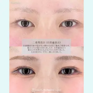症例