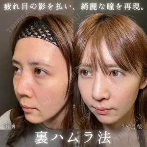eクリニック 福岡院 伊藤 渉医師の症例