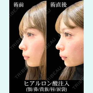 HAAB×DREAM BEAUTY CLINIC 東京本院 佐野 圭医師の症例