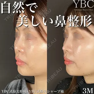 症例