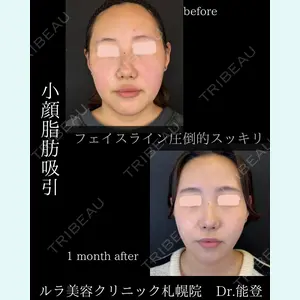 ルラ美容クリニック 新潟院 能登 貴弘医師の症例
