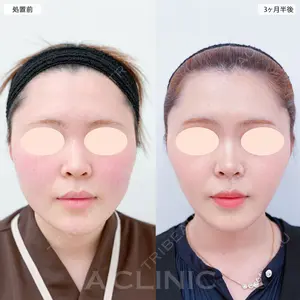 A CLINIC（エークリニック） 大阪院 田窪 賢志郎医師の症例