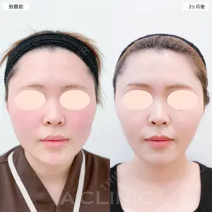 A CLINIC（エークリニック） 大阪院 田窪 賢志郎医師の症例