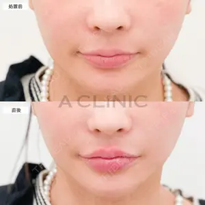 A CLINIC（エークリニック） 大阪院 田窪 賢志郎医師の症例
