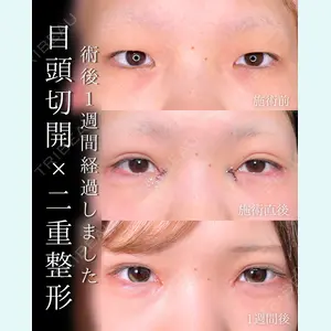 症例