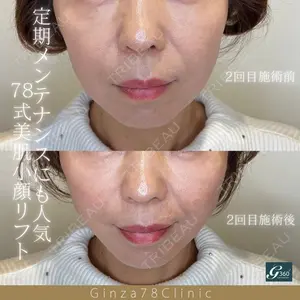 症例