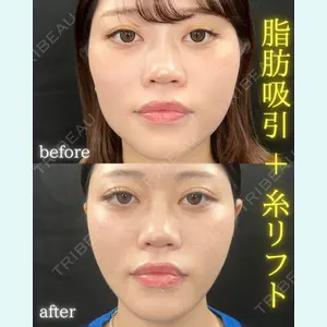 THE FIRST CLINIC 町田院 木暮 啓一郎医師の症例