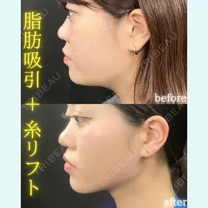 THE FIRST CLINIC 町田院 木暮 啓一郎医師の症例