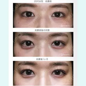 聖心美容クリニック 札幌院 前多 一彦医師の症例