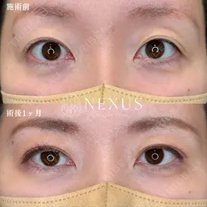 症例