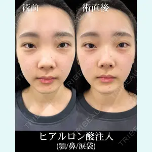HAAB×DREAM BEAUTY CLINIC 東京本院 佐野 圭医師の症例