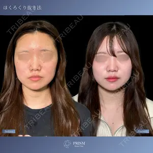 症例