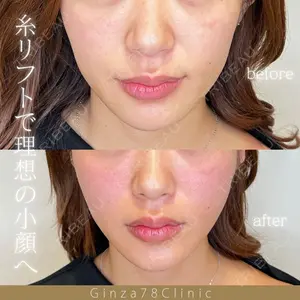Ginza 78 Clinic 田中医師の症例