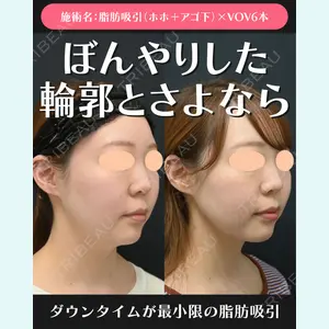 湘南美容クリニック 川崎院 伊藤 賀敏医師の症例