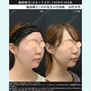 湘南美容クリニック 川崎院 伊藤 賀敏医師の症例
