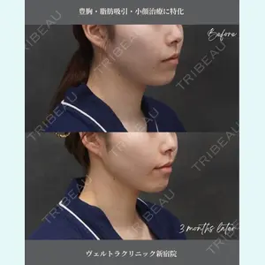 ヴェルトラクリニック 大阪院 西村 秀典医師の症例