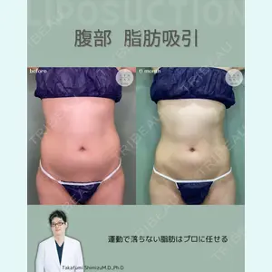 症例
