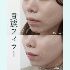 L‘amour clinic Tokyo【ラムールクリニック東京】の症例