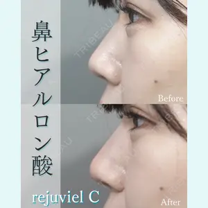L‘amour clinic Tokyo【ラムールクリニック東京】の症例