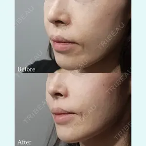 L‘amour clinic Tokyo【ラムールクリニック東京】の症例
