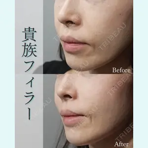 L‘amour clinic Tokyo【ラムールクリニック東京】の症例