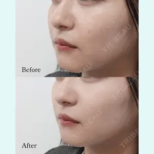 L‘amour clinic Tokyo【ラムールクリニック東京】の症例